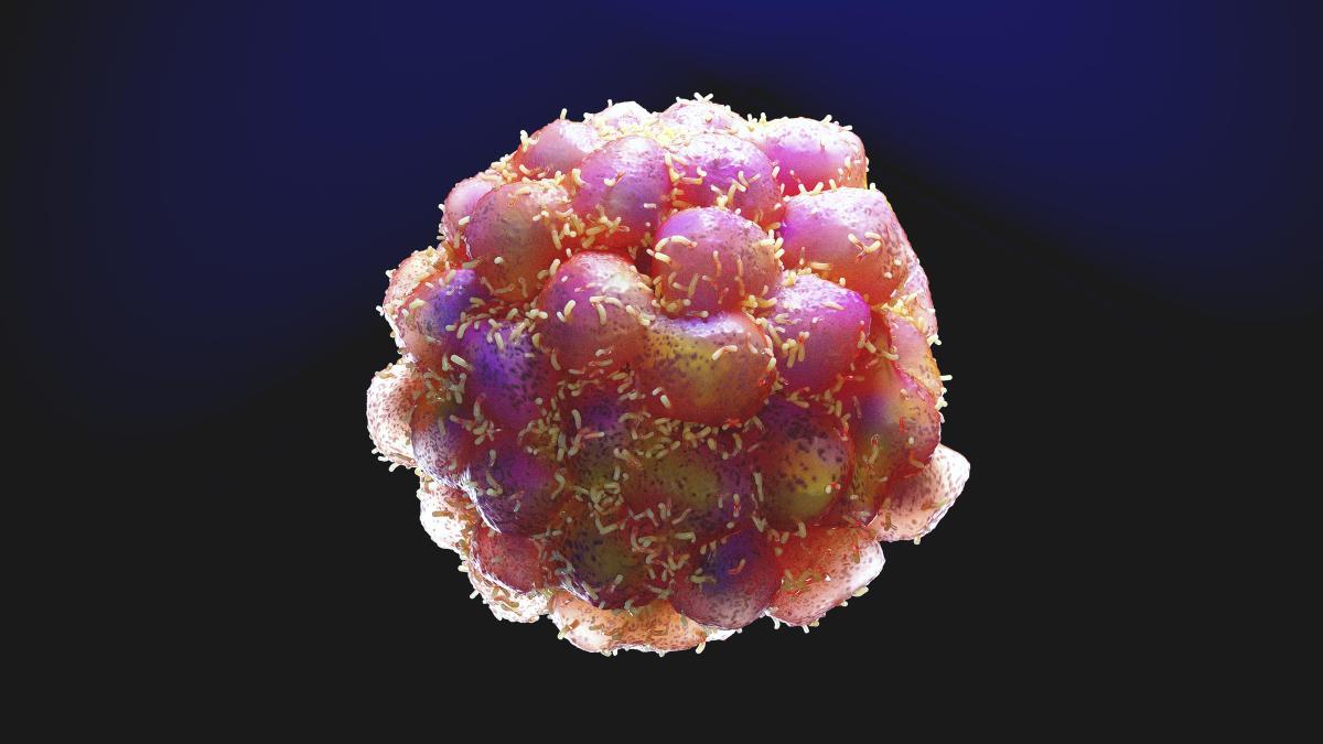 Finding proteins that begin with breast cancer metastasis and can be prevented by drugs