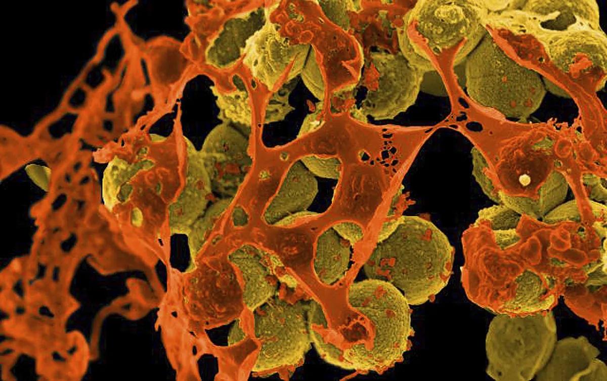 Who warns of growing global antibiotic bacteria |Wealth
