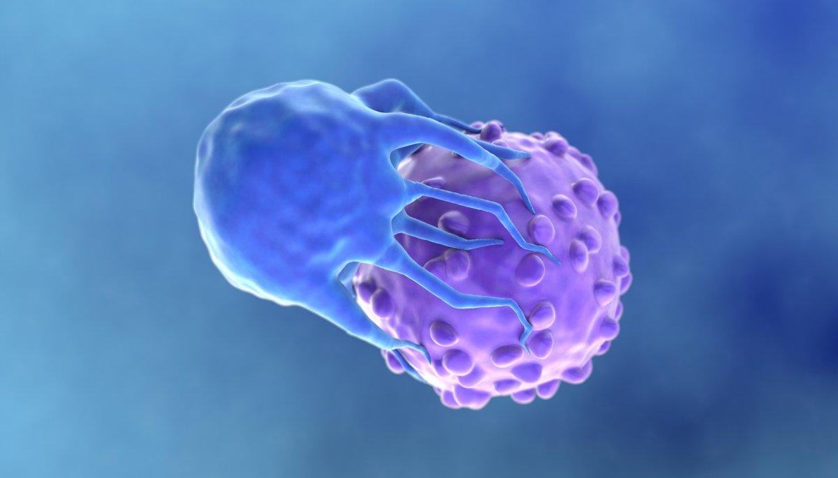 Pediatría del sarcoma: rastrear las afirmaciones españolas sobre la celda CAR-T Resultados brillantes
