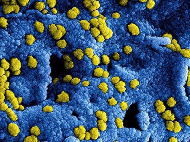 La OMS advierte sobre nuevos casos de MERS-CoV en 2025