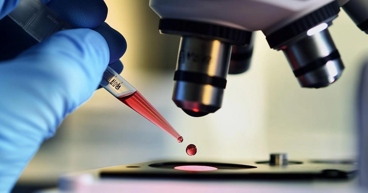 They choose that the blood test can get Expand to a decade in 10 years in 10 years as first symbols ...